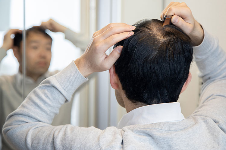 AGAのイメージ画像