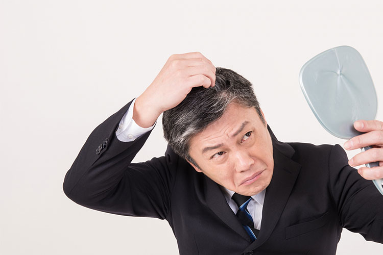 円形脱毛症のイメージ画像