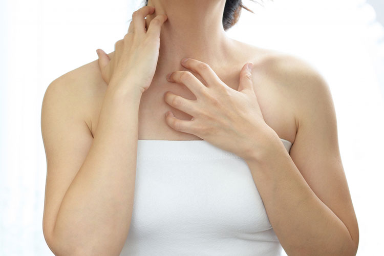 湿疹のイメージ画像