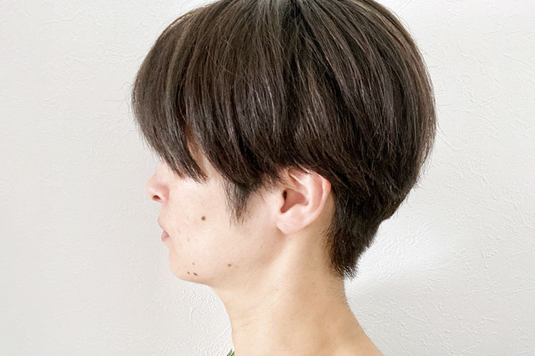 ほくろのイメージ画像