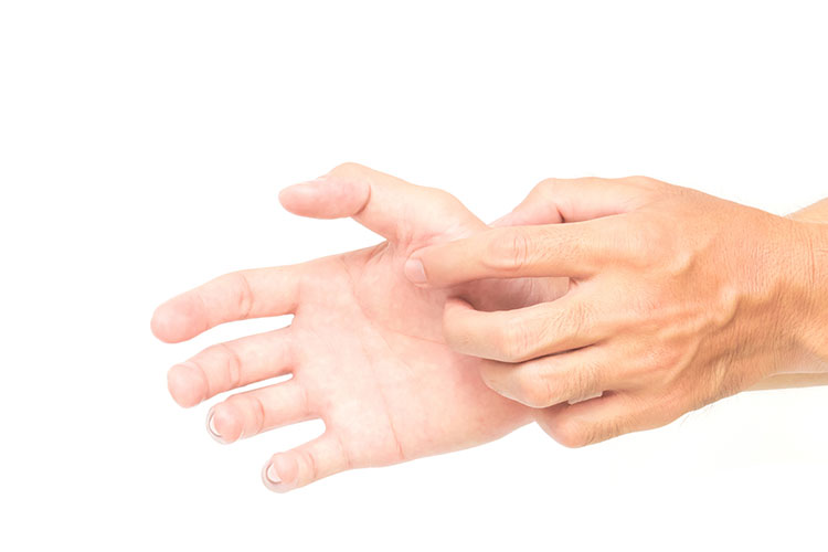 掌蹠膿疱症のイメージ画像